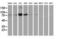 Signal Transducer And Activator Of Transcription 5A antibody, LS-C172879, Lifespan Biosciences, Western Blot image 