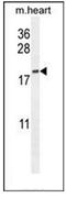 Outer Dense Fiber Of Sperm Tails 3B antibody, AP52990PU-N, Origene, Western Blot image 