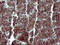 Mitogen-Activated Protein Kinase Kinase 1 antibody, LS-C787976, Lifespan Biosciences, Immunohistochemistry paraffin image 