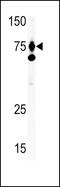 Hepatocyte Growth Factor antibody, 59-064, ProSci, Western Blot image 
