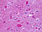 Cadherin EGF LAG Seven-Pass G-Type Receptor 2 antibody, TA340631, Origene, Immunohistochemistry frozen image 