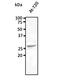 RAB5C, Member RAS Oncogene Family antibody, orb182401, Biorbyt, Western Blot image 