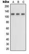 Neuropilin 1 antibody, MBS821583, MyBioSource, Western Blot image 