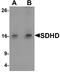 Succinate Dehydrogenase Complex Subunit D antibody, A01261, Boster Biological Technology, Western Blot image 