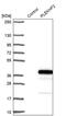 Pleckstrin Homology And FYVE Domain Containing 2 antibody, PA5-55199, Invitrogen Antibodies, Western Blot image 