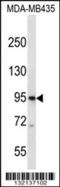Cyclic Nucleotide Gated Channel Beta 3 antibody, 56-597, ProSci, Western Blot image 