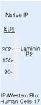 Laminin Subunit Beta 2 antibody, MA5-14649, Invitrogen Antibodies, Immunoprecipitation image 