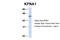 Karyopherin Subunit Alpha 1 antibody, NBP1-54603, Novus Biologicals, Immunohistochemistry paraffin image 