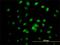 Interferon Related Developmental Regulator 2 antibody, H00007866-M01, Novus Biologicals, Immunocytochemistry image 
