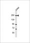 Coiled-Coil Domain Containing 58 antibody, orb2332, Biorbyt, Western Blot image 