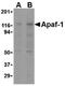 Apoptotic Peptidase Activating Factor 1 antibody, MA5-15743, Invitrogen Antibodies, Western Blot image 