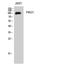 Protein Kinase D1 antibody, STJ95135, St John
