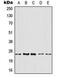 ADP Ribosylation Factor 4 antibody, orb216021, Biorbyt, Western Blot image 