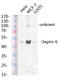 Septin 6 antibody, GTX34192, GeneTex, Western Blot image 