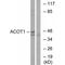 Acyl-CoA Thioesterase 1 antibody, PA5-49967, Invitrogen Antibodies, Western Blot image 