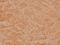 Mitogen-Activated Protein Kinase Kinase 1 antibody, A00292T286, Boster Biological Technology, Immunohistochemistry frozen image 