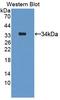 Complement C5 antibody, LS-B15256, Lifespan Biosciences, Western Blot image 