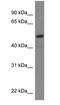 Transcription factor SOX-5 antibody, PA1-30863, Invitrogen Antibodies, Western Blot image 