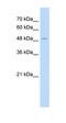 Aminoadipate Aminotransferase antibody, orb330311, Biorbyt, Western Blot image 