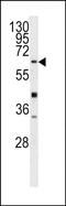 Gamma-Glutamyltransferase 5 antibody, PA5-72515, Invitrogen Antibodies, Western Blot image 