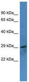 Coagulation Factor VII antibody, TA342830, Origene, Western Blot image 