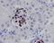 WT1 Transcription Factor antibody, M00199-1, Boster Biological Technology, Immunohistochemistry paraffin image 