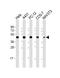 Mitogen-Activated Protein Kinase Kinase 1 antibody, M00292-3, Boster Biological Technology, Western Blot image 