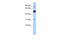 BEN Domain Containing 2 antibody, 31-300, ProSci, Western Blot image 