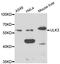 Unc-51 Like Kinase 3 antibody, LS-C349257, Lifespan Biosciences, Western Blot image 