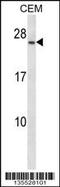 CD79a antibody, 58-110, ProSci, Western Blot image 