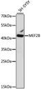 Myocyte Enhancer Factor 2B antibody, 16-364, ProSci, Western Blot image 
