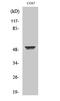 Keratin 8 antibody, STJ92640, St John