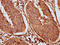 Keratin 18 antibody, CSB-PA012519LA01MO, Cusabio, Immunohistochemistry paraffin image 