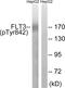 Fms Related Tyrosine Kinase 3 antibody, LS-C198965, Lifespan Biosciences, Western Blot image 