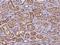 Oxysterol Binding Protein Like 9 antibody, 200672-T08, Sino Biological, Immunohistochemistry paraffin image 