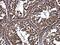 RB1 Inducible Coiled-Coil 1 antibody, GTX107387, GeneTex, Immunohistochemistry paraffin image 