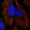 Parvin Beta antibody, HPA062601, Atlas Antibodies, Immunofluorescence image 