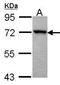 G Protein-Coupled Receptor Kinase 3 antibody, GTX102493, GeneTex, Western Blot image 