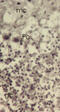 Thioredoxin Like 1 antibody, 57-017, ProSci, Immunohistochemistry paraffin image 