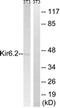 Potassium Voltage-Gated Channel Subfamily J Member 11 antibody, LS-B7661, Lifespan Biosciences, Western Blot image 