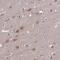 Tubulin Folding Cofactor B antibody, NBP1-85672, Novus Biologicals, Immunohistochemistry frozen image 