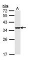 BCL2 Interacting Protein 3 Like antibody, PA5-29385, Invitrogen Antibodies, Western Blot image 