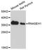 RNase H1 antibody, STJ111576, St John