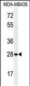 Syntaxin 19 antibody, PA5-48216, Invitrogen Antibodies, Western Blot image 