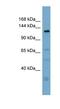 Anoctamin 3 antibody, NBP1-70409, Novus Biologicals, Western Blot image 