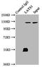 Large Tumor Suppressor Kinase 1 antibody, LS-C678477, Lifespan Biosciences, Immunoprecipitation image 