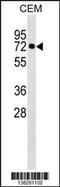 Kelch Like Family Member 28 antibody, 59-837, ProSci, Western Blot image 