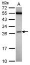 FA Core Complex Associated Protein 24 antibody, NBP2-16398, Novus Biologicals, Western Blot image 