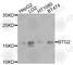 BTG Anti-Proliferation Factor 2 antibody, A9848, ABclonal Technology, Western Blot image 