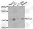 Protein BTG2 antibody, A9848, ABclonal Technology, Western Blot image 